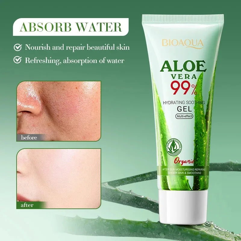 Gel Aloe Vera 99% Pur — Soin Hydratant Visage & Corps, Apaisant, Anti-Acné, Peaux Sensibles