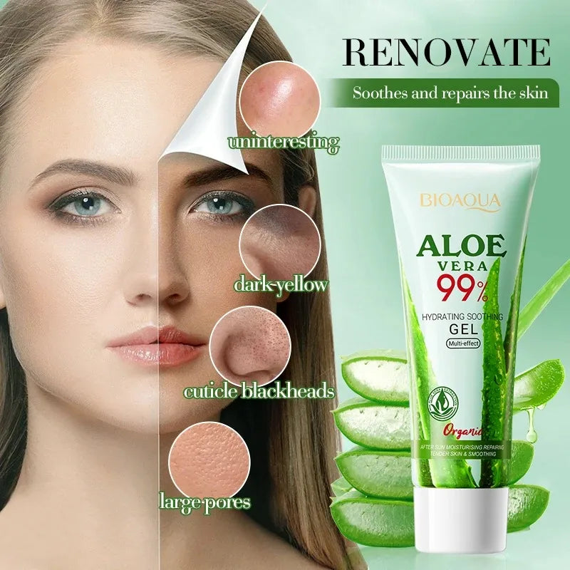 Gel Aloe Vera 99% Pur — Soin Hydratant Visage & Corps, Apaisant, Anti-Acné, Peaux Sensibles
